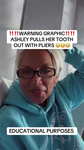@🌈ashley🌈 THIS GIRL PULLS HER TOOTH OUT WIRH PLIERS 😳😳😳 #funnyvideos #dentist #tooth #crazy #fypシ゚viral