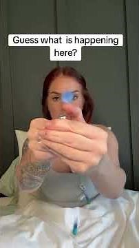 esophagectomy is a surgical procedure to remove all or part of the esophagus