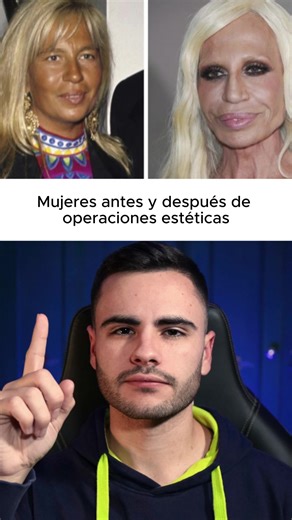 Transformaciones Impactantes: Mujeres y Cirugías Estéticas