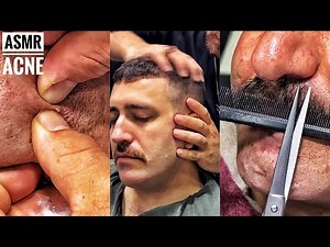Asmr Beard Cutting • Acne removal and head massage long version