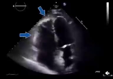 What is the Echo Sign?