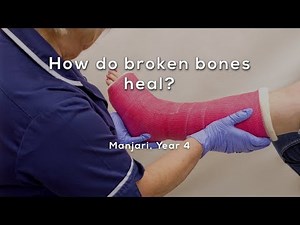 How do broken bones heal?