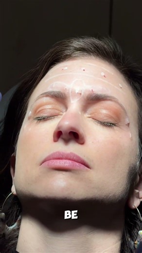 🌵 Inside a Live Botox® Demo at One of America's Top Aesthetic Symposiums