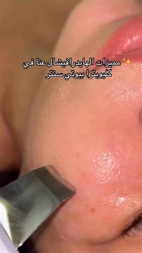 ‎خبيرة البشرة سونه المحتسب‎ on Instagram‎: "ليش الهايدرافيشال عنا في مركز كليوبترا مختلف؟ لأنه مش مجرد جلسة تنظيف عادية… هو برنامج عناية متكامل بخطوات مدروسة ونتائج فورية 👌 🔹 تنظيف عميق للمسام بدون ألم 🔹 تقشير لطيف يزيل الخلايا الميتة 🔹 سحب الرؤوس السوداء باحتراف 🔹 ترطيب عالي للبشرة من أول جلسة 🔹 توحيد لون وإشراقة فورية 🔹 مناسب لكل أنواع البشرة حتى الحساسة 🔹 جلسة آمنة بدون احمرار مزعج أو فترة تعافي والأهم: كل جلسة عنا بتكون بعد تشخيص دقيق للبشرة، مع اختيار سيرومات وخطوات مناسبة لاحتياجك 