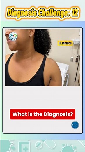 Painful Axillary Lesions – Can You Diagnose This? 🤔