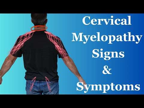 Cervical Myelopathy Signs and Symptoms (Revisited)