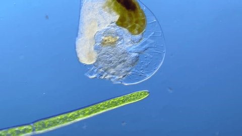 clip-3998868237-epiphanes-rotifer-under-microscope-100x-magnification