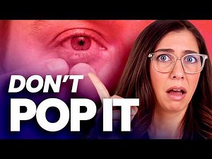 Do NOT Pop a Stye! Here’s How to Actually Treat It Safely