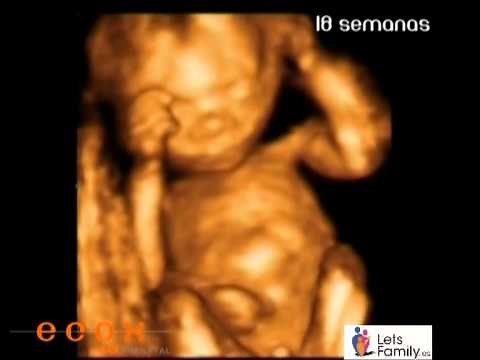 Ecografía 4D: el bebé con 18 semanas de gestación