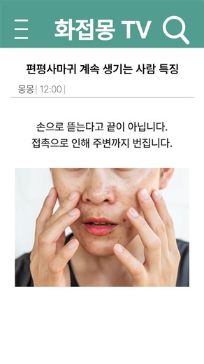 편평사마귀 재발하는 진짜 이유