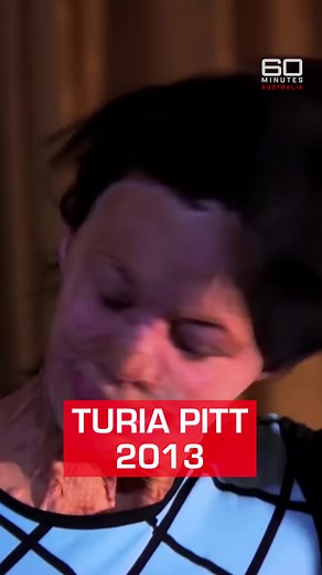 60 most memorable moments on #60Mins, #43: Turia Pitt unmasked for the first time after surviving burning from a grassfire. Watch the full story: https://www.youtube.com/watch?v=I60WGzewsh8