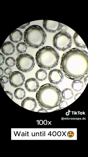 Beer Under Microscope: A Fascinating Look at 400x Magnified Brew