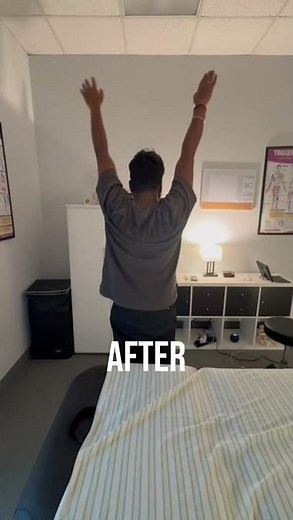 💪 Shoulder Impingement Relief in Just 1 Visit!