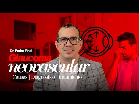 GLAUCOMA NEOVASCULAR: causas, diagnostico y tratamiento