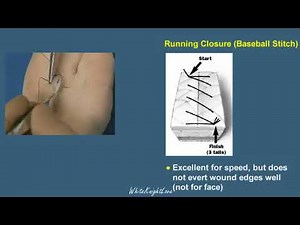 7 4 Running Closure Suture Techniques Essential Surgical Skills WhiteKnightLove