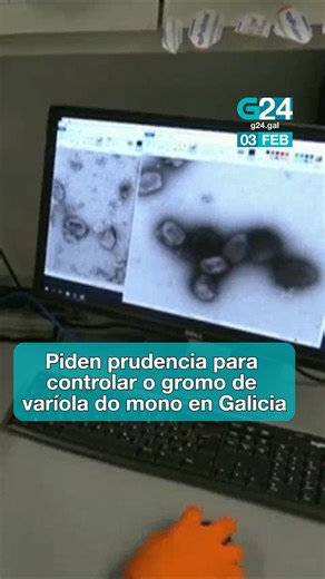 G24noticias on Instagram: "😷 GALICIA Sanidade pide extremar a precaución tras a detección de nove casos de varíola do mono Toda a información, en G24.gal e G24play.gal #Galicia #noticias #galego "Detectamos nove casos, que poden parecer poucos, pero son máis dos detectados en todo o ano anterior", explica Suso Prego, o xefe do Servizo de Vixilancia Epidemiolóxica. Advirte de que o número de positivos podería seguir medrando dado que os últimos casos confirmados son aínda recentes. E por iso os 