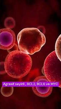 Treatment of Early-Stage High-Grade B-Cell Lymphoma