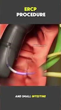 ERCP Procedure Explained | Endoscopic Retrograde Cholangiopancreatography #medicaleducation