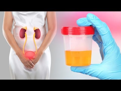 Mjekët po na e fshehin: Shpëtoni nga infeksionet urinare me këtë recetë vetëm me 2 përbërës