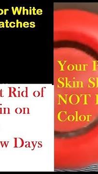 Red Penis? How to Get Rid of Redness on Foreskin, Gland and Shaft in 2 Days Flat!