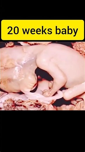 20 Weeks Baby Ultrasound | Baby Kicking in Womb 💕