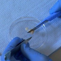 Video: In vivo Postnatal Electroporation and Time-lapse Imaging of Neuroblast Migration in Mouse Acute Brain Slices