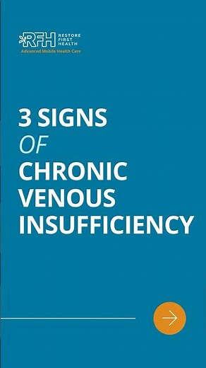 3 Warning Signs of Chronic Venous Insufficiency | Leg Swelling, Heaviness & Skin Changes