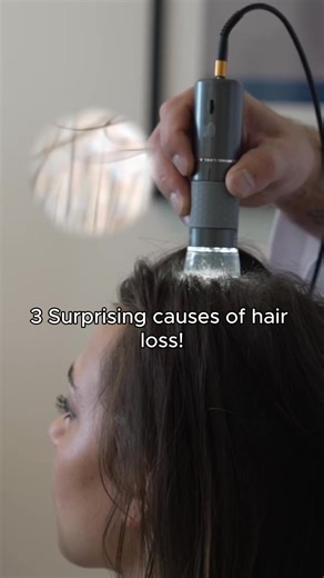 Struggling with thinning hair or hair loss? You might not know the root cause. Our microscopic scalp analysis reveals the 3 surprising causes of hair loss: - Hair follicle miniaturization- - Decreased hair density - Scalp build-up Understanding these issues is the first step to thicker, healthier hair. Tap below to schedule your consultation and uncover what your hair needs to thrive! | Palm Beach Health Works