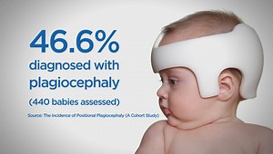 How restrictive baby equipment can hinder development