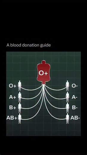 Random Videos on Instagram: "This simple chart is a crucial guide to blood compatibility. It shows why your blood type is so important for transfusions, and it’s all based on the presence, or absence, of two key types of molecules on your red blood cells. Think of it like a lock and key. Your blood type (A, B, AB, or O) is determined by tiny markers called antigens on the surface of your red blood cells. Your immune system creates antibodies against any antigen your own blood doesn’t have. If yo