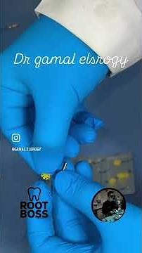 Rotary Files in Endodontics Tips & Tricks for Better Performance