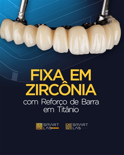 Smart Lab Concept | Fixa em zircônia com reforço de barra em titânio: uma combinação que une resistência estrutural, estabilidade e estética de alto padrão. A... | Instagram