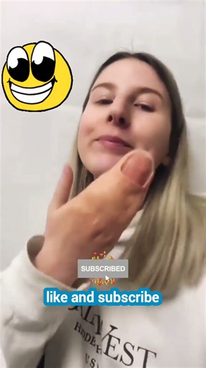 Strange Hand Disease: (Polydactyly Explained) 🔥😮 #shorts #polydactyly