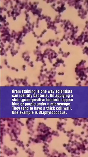 Gram positive cocci in clusters under the microscope #microbiology #bacteria #medtechstudent #mls