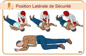 AVC: Voici les Méthodes de sauvetages et premiers secours - Senegal7