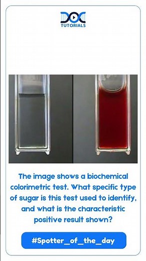 Biochemistry Spotter Challenge: Identify the Sugar Test | DocTutorials
