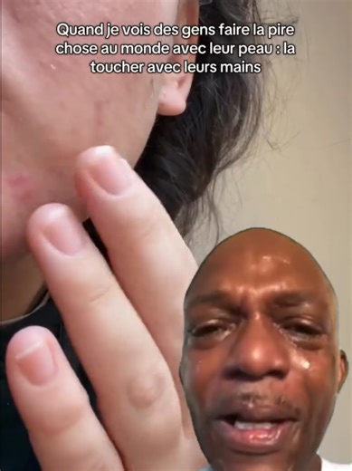 #hygiene #boutons #acne #beauty #viral pack de soins disponible tire comédons solution au boutons disponible au 22870395503