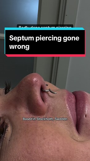 Avoiding Bad Septum Piercing Experiences: Expert Tips and Stories