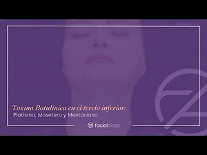 Toxina Botulínica en el tercio inferior: Platisma, Masetero y Mentoniano | Facial Class