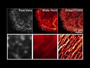 ZeroCostDL4Mic Video #10: Using Deep-STORM to obtain super-resolution microscopy images