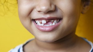 LIttle girl smiling with teeth gaps, milk teeth, primary teeth