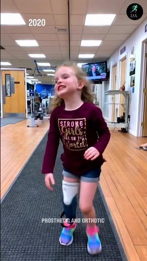 Walking Into Sweet Dreams 🦵 New Artificial Limb, New Life Amputation Recovery Journey #nevergiveup