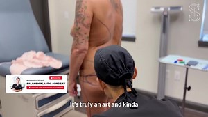 Awake Liposuction to Upper, Lower back & Flanks - PART 1: MARKINGS - Lipo Procedure | Salameh Plastic Surgery Center