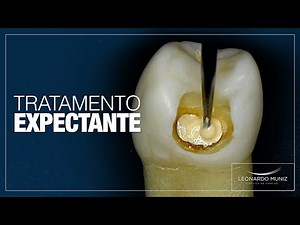 Tratamento Expectante