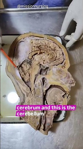 Real Human Brain Anatomy | Brain Parts Explained