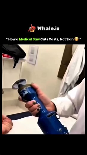 curious thinker on Instagram: "A medical cast saw is specially designed to cut through hard materials like plaster and fiberglass without harming your skin. Instead of spinning like a regular saw, it moves back and forth in tiny vibrations. These vibrations are strong enough to break apart the stiff cast but too gentle to cut soft, flexible skin. This clever design lets doctors safely remove casts without causing injury or pain. #facts #knowledge #didyouknow #fyp #innovation #technology #experim