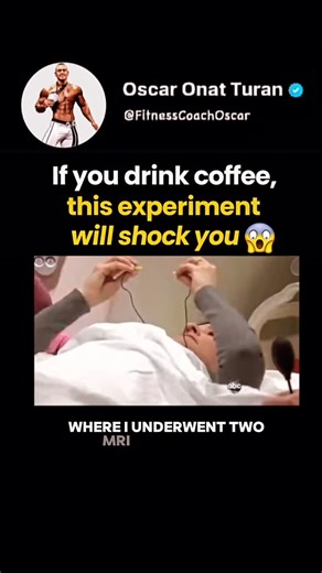 Oscar Onat Turan | Caffeine can affect many bodily functions by stimulating the central nervous system. One of these effects is blocking a compound in the... | Instagram