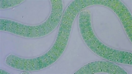 显微镜下的蓝藻（Cyanobacteria ）