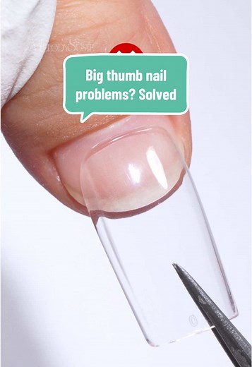 Solving Big Thumb Nail Problems: Tips & Tricks