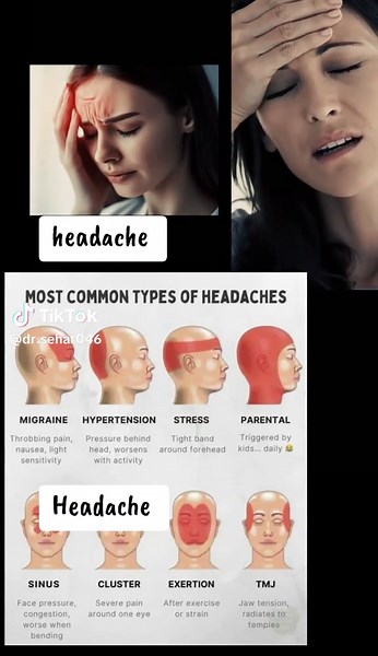 Understanding Different Types of Headaches